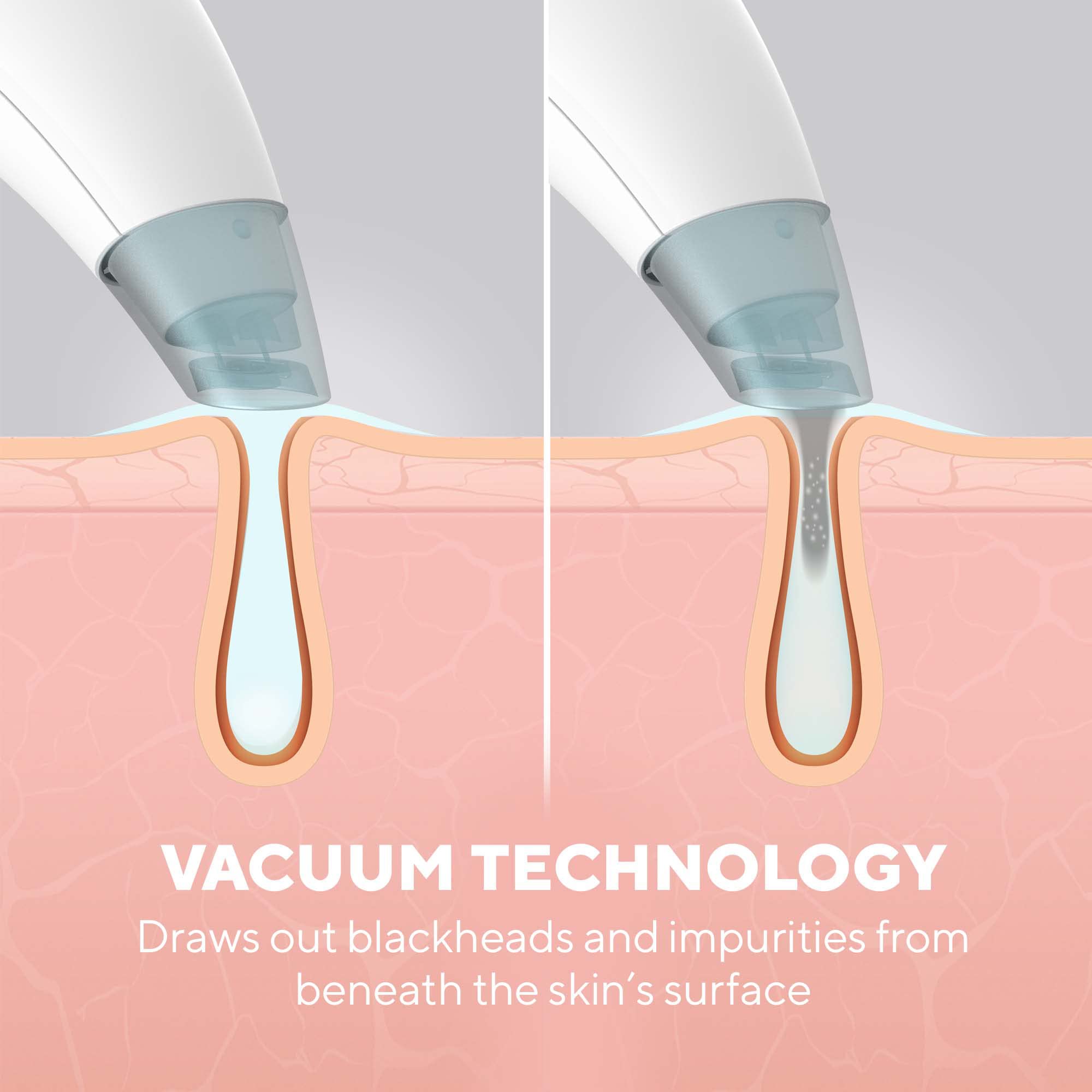 homedics-refresh-hydradermabrasion-cleanser-mikrodermabrasionsger-t-mit-vakuum-m image 5