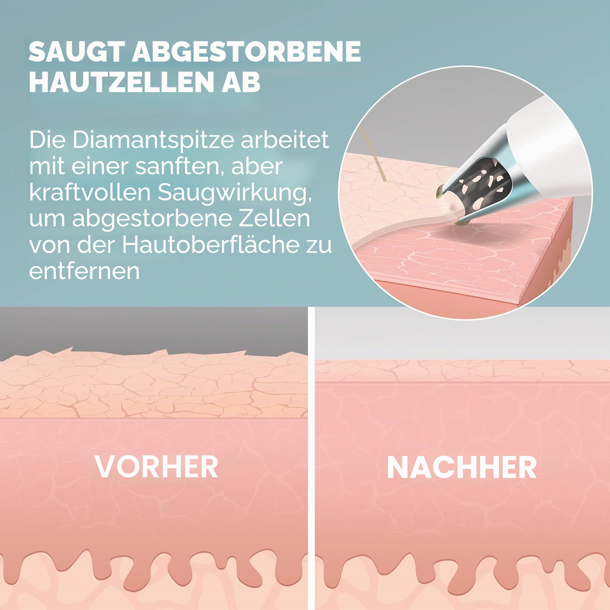 homedics-remove-mikrodermabrasionsger-t-mit-k-hlender-hautpflege-4-intensit-tsst image 5